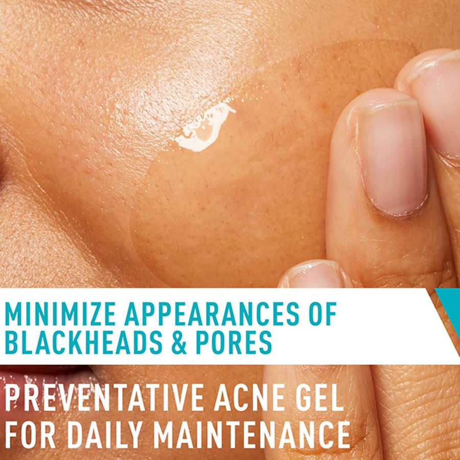 CERAVE Acne Blemish Control Gel 40ml for Ubat Jerawat, Acne Cream, Acne Spot Treatment