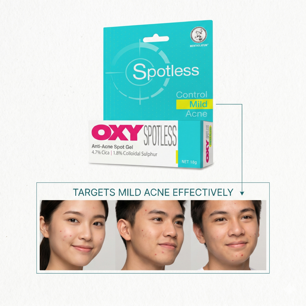 OXY Anti Acne Spotless Gel 18g for Mild Acne, Acne Gel, Krim Jerawat, Ubat Jerawat