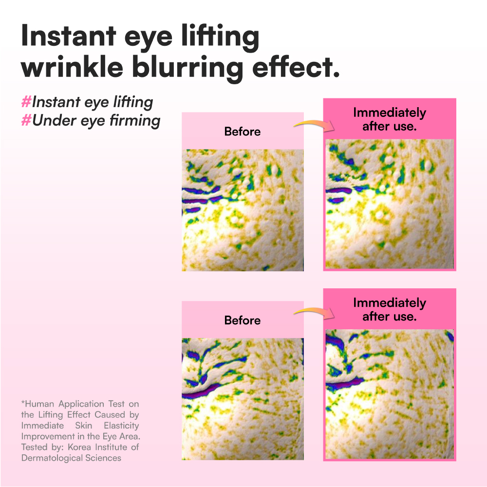 FACE REPUBLIC Blooming Collagen Eye Booster 15ml for Eye Serum, Eye Cream for Eye Lifting
