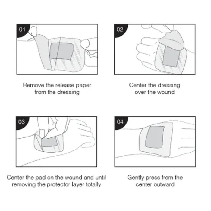 TOPSEAL WOUND DRESSING POST-OP 10 X 10CM 25'S