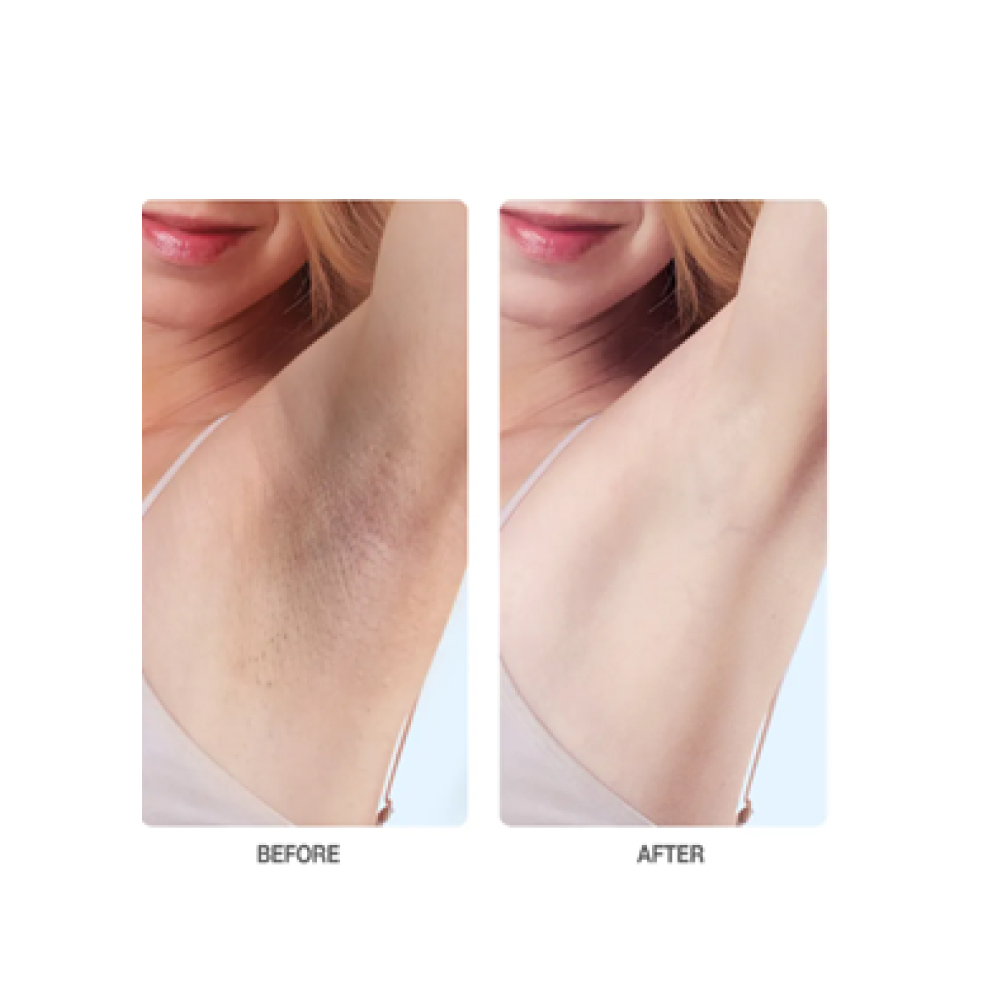 DERMAE Mint Deodorant Cream 60ml for Krim Deodorant, Ubat Ketiak, Underarm Cream