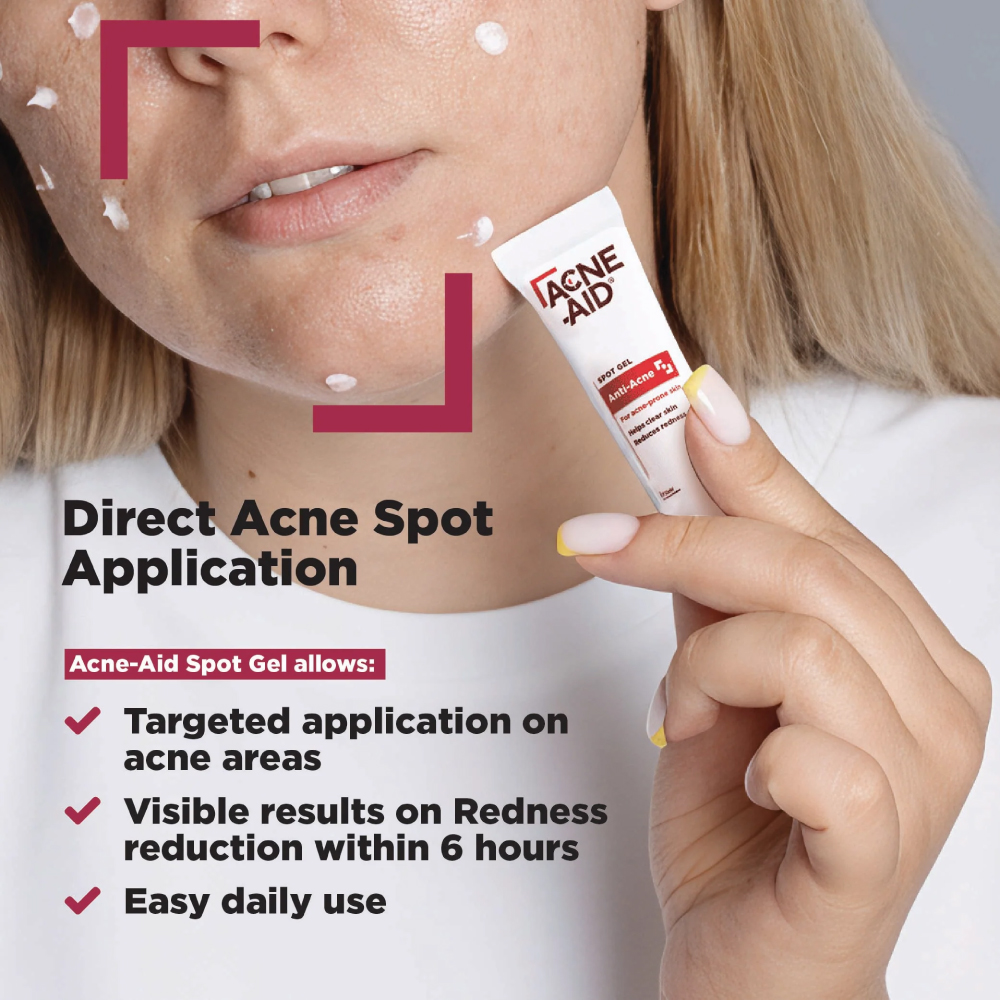 ACNE-AID Spot Gel 10g for Acne Gel, Acne Cream, Krim Jerawat, Spot Treatment Gel