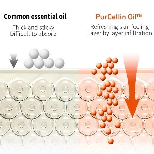 BIO-OIL Skincare Oil 200ml for Stretch Mark Oil, Minyak Penjagaan Parut