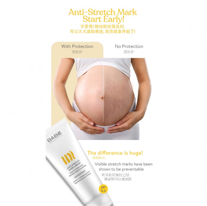 BABE LABORATORIOS Anti Stretch Mark Cream 200ml with Rosehip Oil (for All Skin Types)