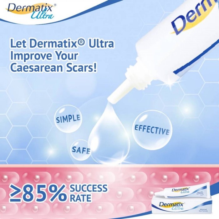 DERMATIX Ultra Gel 30g -Skin Care, Scar Gel, Gel