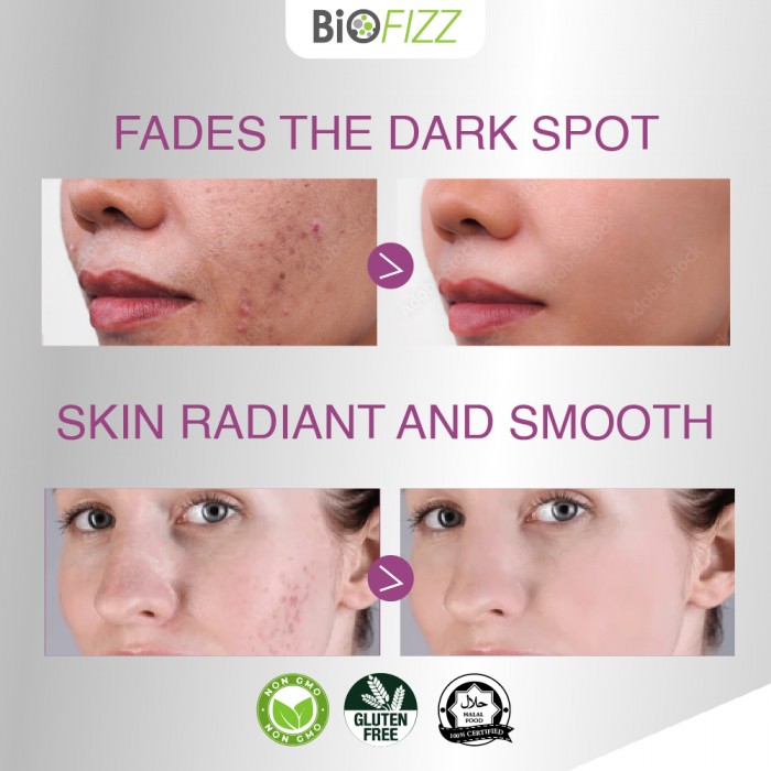 BIOFIZZ Bliss Black Seed Extract Gummies 2.5g X 8's for Immunity Booster, Respiratory Health, Gummy, 软糖