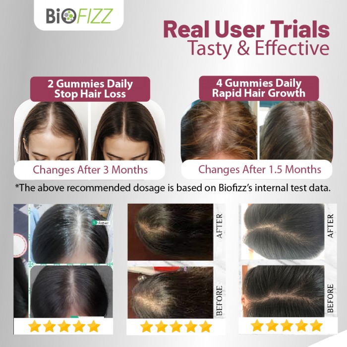 BIOFIZZ Dewyglo Dewy Skin Gummies 2.5g X 8's for Hair, Nail, Skin Supplement with Biotin, 软糖