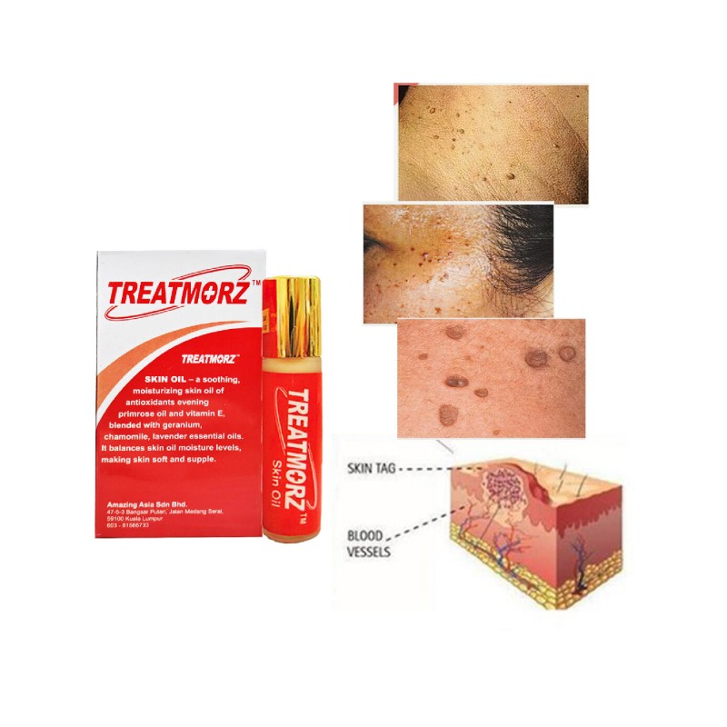 Treatmorz Skin Oil 8ml