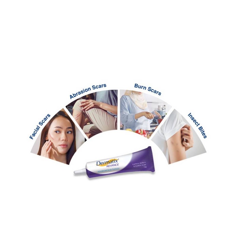 DERMATIX Advance 15g -Skin Care, Scar Gel, Gel