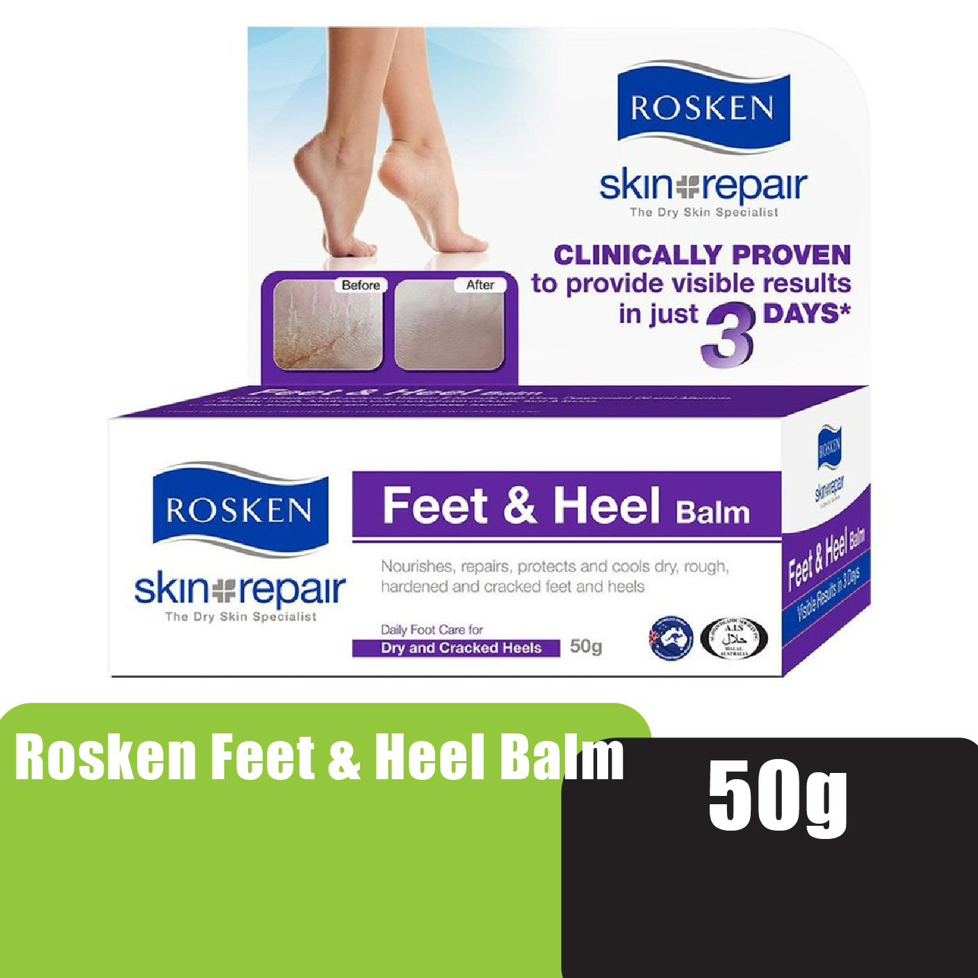 ROSKEN Feet & Heel Balm 50g sensitive & dry skin lotion kulit kering 皮膚 敏感 止癢